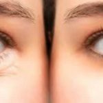 Panduan Lengkap Cara Mengurangi Kantung Mata Secara Permanen Untuk Penampilan Lebih Segar